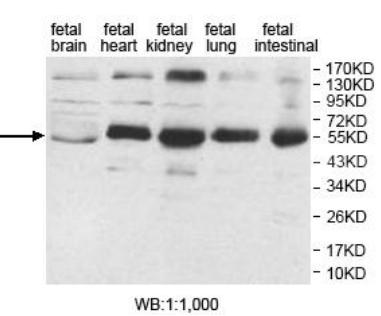 Anti-AP1M2 Antibody
