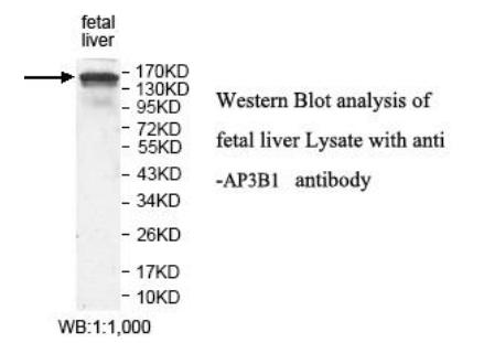 Anti-AP3B1 Antibody