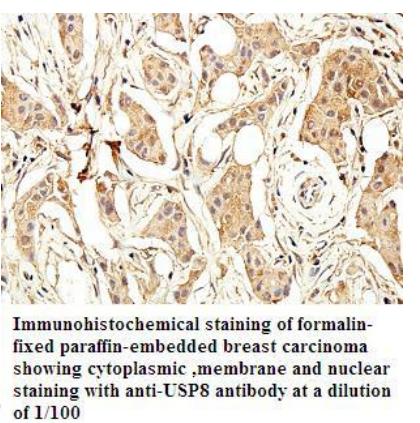 Anti-USP8 Antibody
