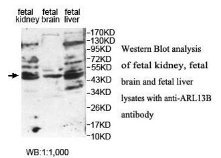 Anti-ARL13B Antibody