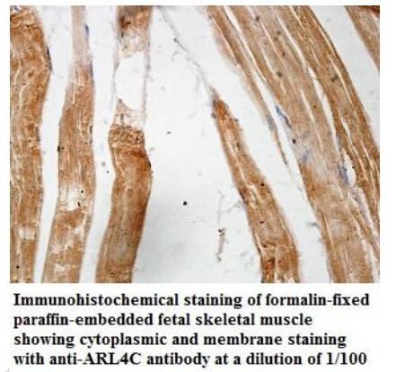 Anti-ARL4C Antibody