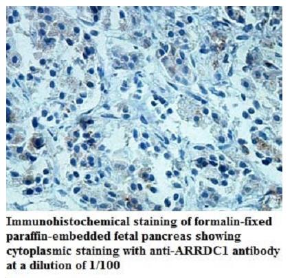 Anti-ARRDC1 Antibody