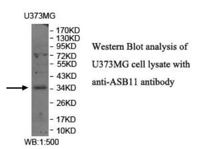 Anti-ASB11 Antibody