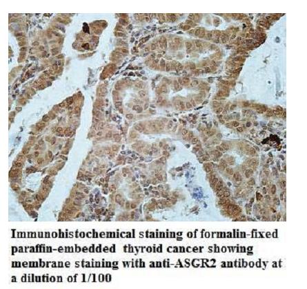 Anti-ASGR2 Antibody