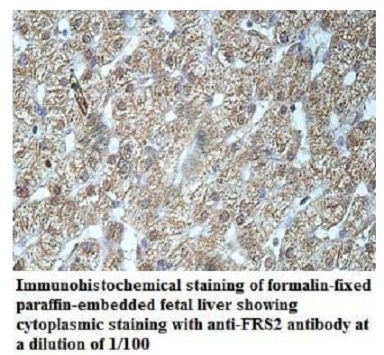 Anti-FRS2 Antibody
