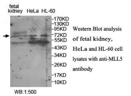 Anti-MLL5 Antibody
