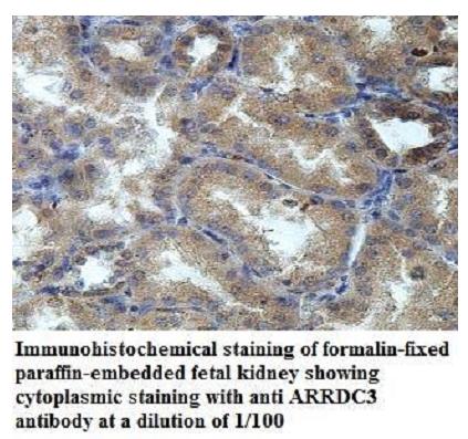 Anti-ARRDC3 Antibody