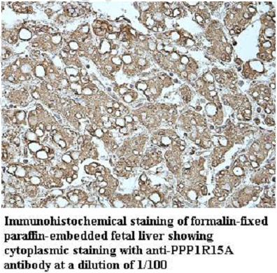 Anti-PPP1R15A Antibody