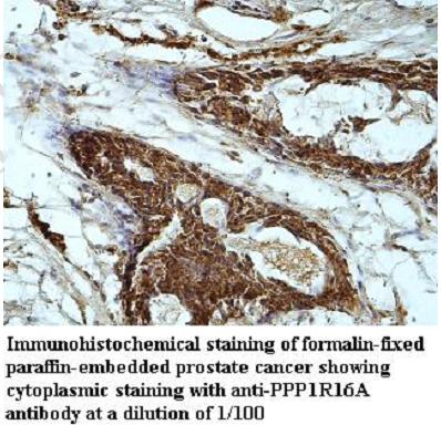 Anti-PPP1R16A Antibody