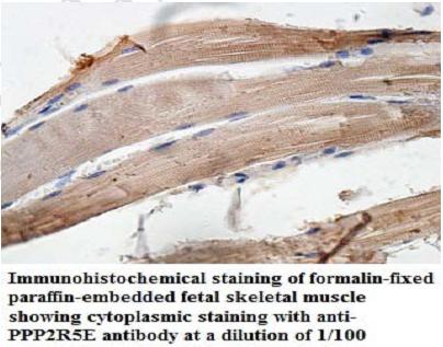 Anti-PPP2R5E Antibody
