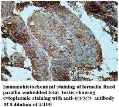 Anti-EIF2C3 Antibody