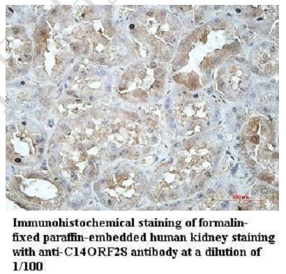 Anti-C14ORF28 Antibody