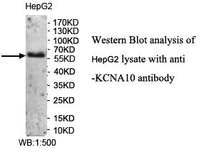 Anti-KCNA10 Antibody