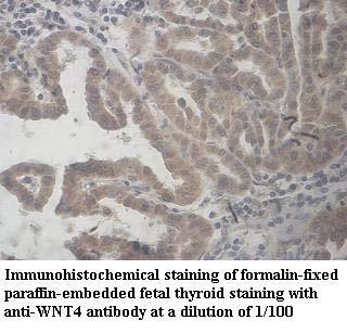 Anti-WNT4 Antibody
