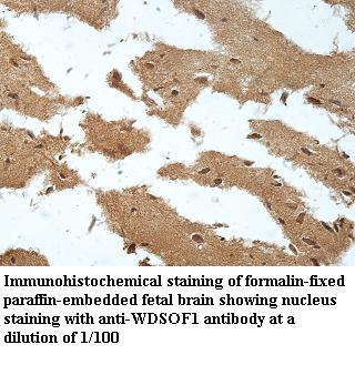 Anti-WDSOF1 Antibody