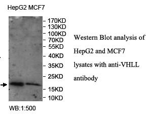 Anti-VHLL Antibody