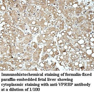 Anti-VprBP Antibody