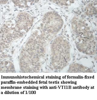 Anti-VTI1B Antibody