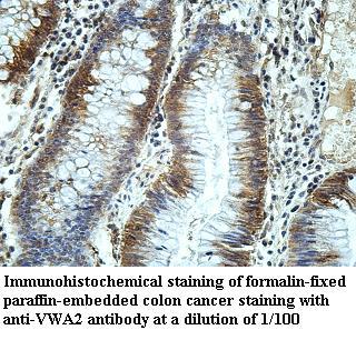 Anti-VWA2 Antibody