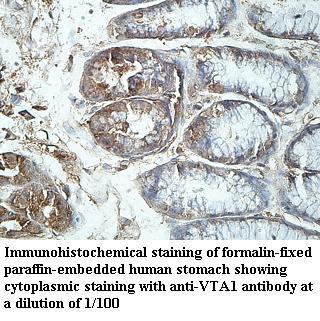Anti-VTA1 Antibody