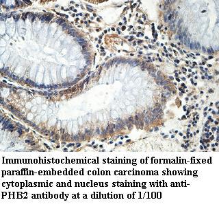 Anti-PHB2 Antibody