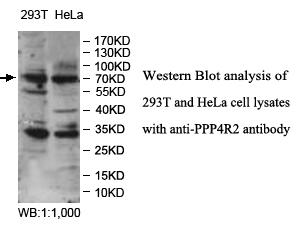 Anti-PPP4R2 Antibody