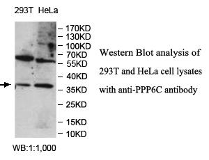 Anti-PPP6C Antibody