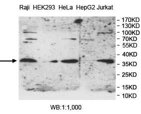 Anti-PPT1 Antibody