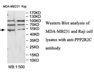 Anti-PPP2R2C Antibody