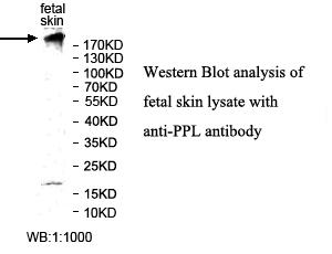 Anti-PPL Antibody