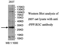 Anti-PPP1R3C Antibody