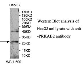 Anti-PRKAB2 Antibody