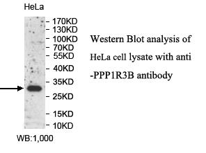 Anti-PPP1R3B Antibody