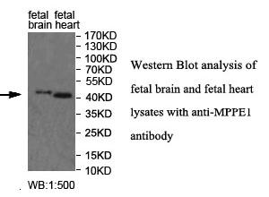 Anti-MPPE1 Antibody