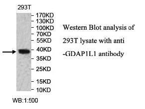Anti-GDAP1L1 Antibody