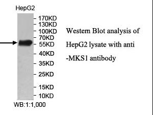 Anti-MKS1 Antibody