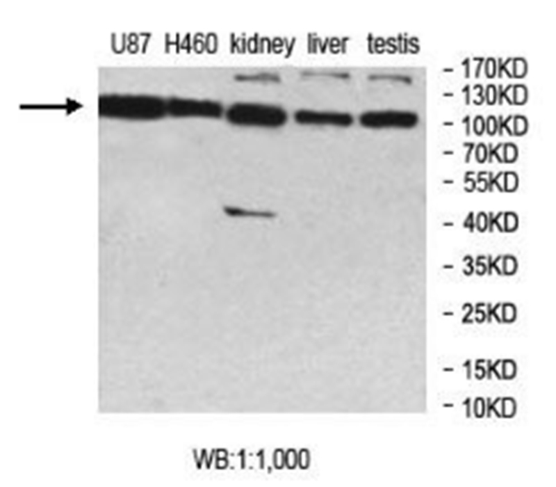 Anti-MCTP2 Antibody