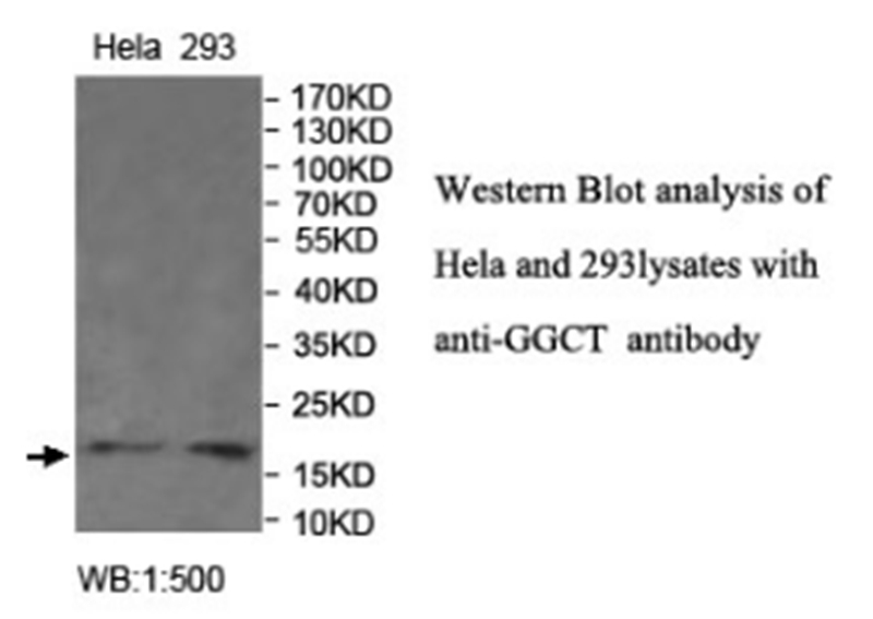 Anti-GGCT Antibody