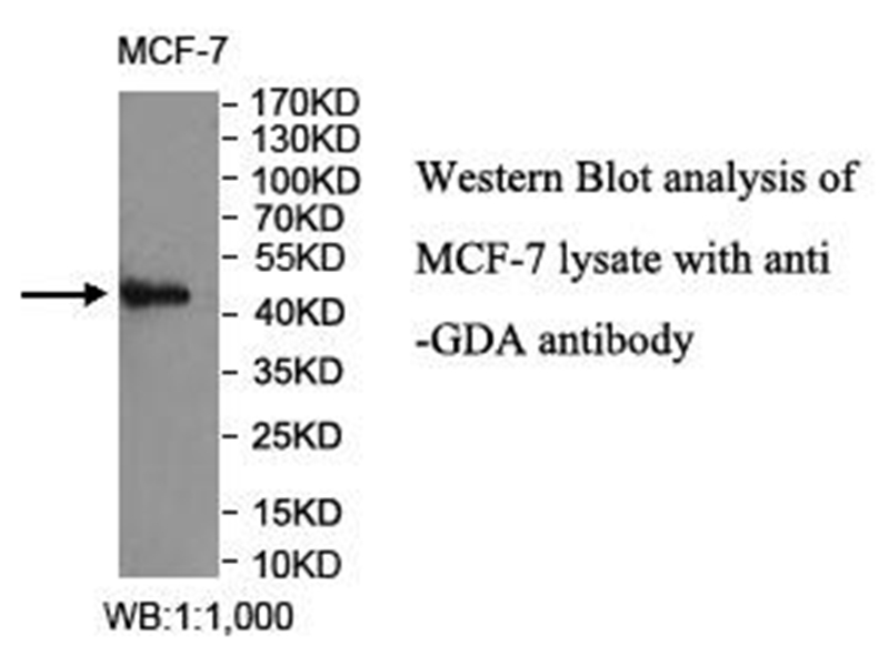Anti-GDA Antibody
