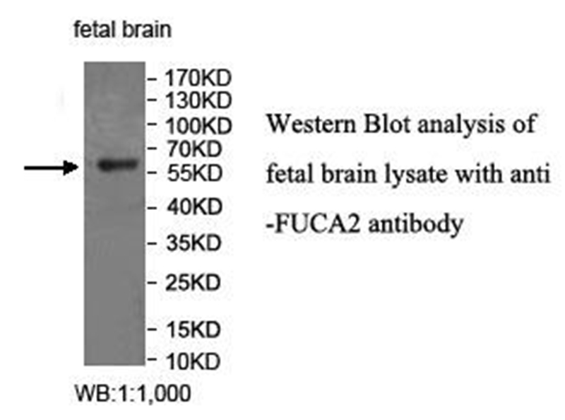 Anti-FUCA2 Antibody