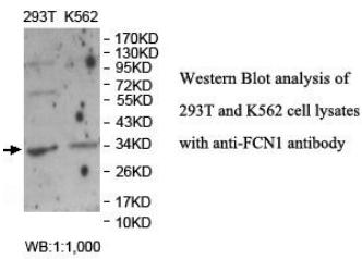 Anti-FCN1 Antibody