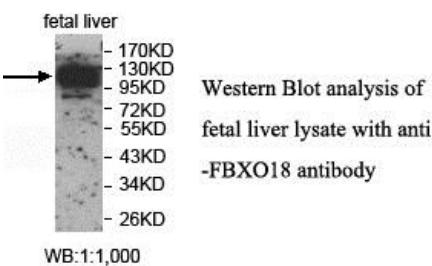 Anti-FBXO18 Antibody