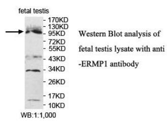 Anti-ERMP1 Antibody