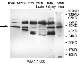 Anti-EFHA1 Antibody