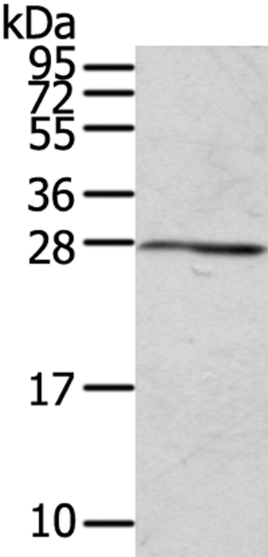 RAB20 Antibody