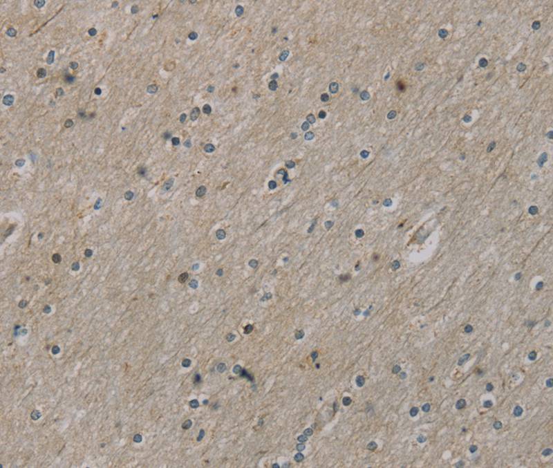 ROBO4 Antibody