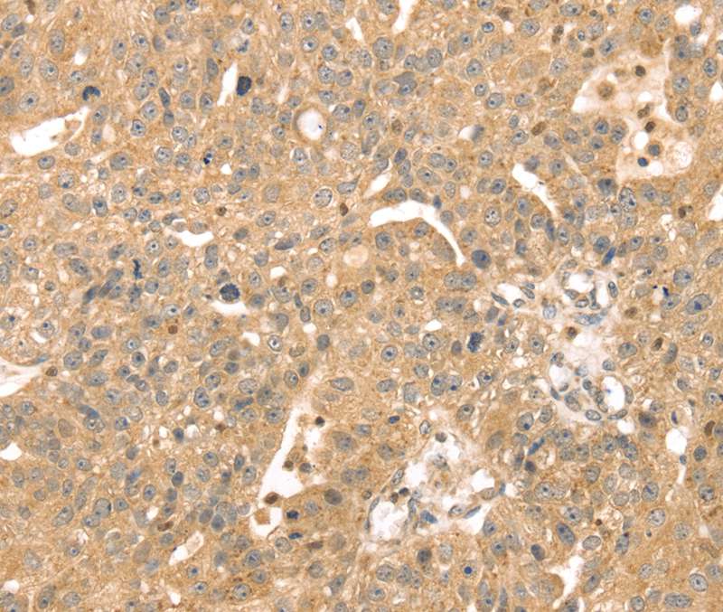 ATOX1 Antibody