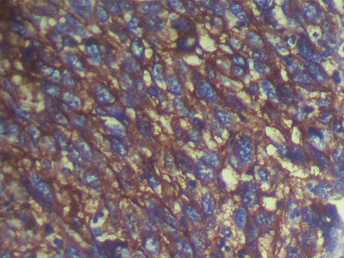 S100A14 Antibody