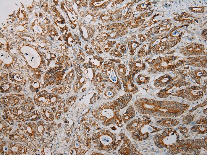 SNX27 Antibody