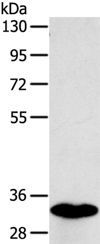 SULT1B1 Antibody